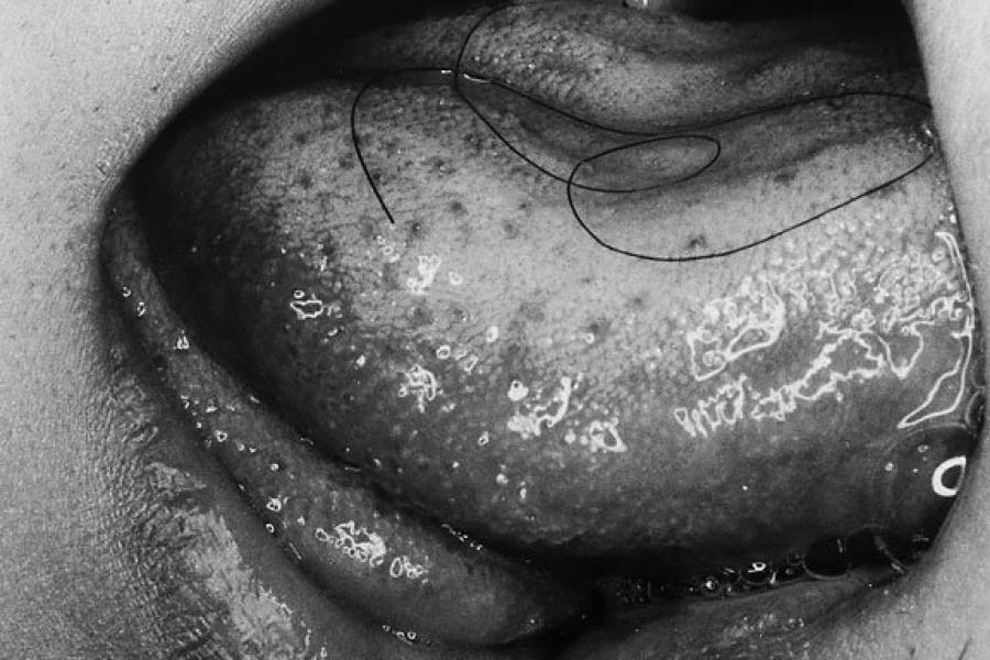 NOBUYOSHI ARAKI Tongue From the series: Erotos Japan, 1993 Gelatin silver print, printed later 39,5 x 29,5 cm Verso: signed in pencil © Nobuyoshi Araki / WestLicht, Vienna