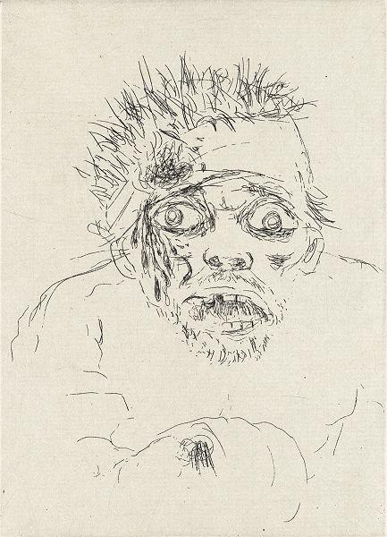 Otto Dix (1891 – 1969) Fliehender Verwundeter (Sommerschlacht 1916), 1924 Radierung, 197 x 140 mm © Hamburger Kunsthalle / bpk Photo: Christoph Irrgang