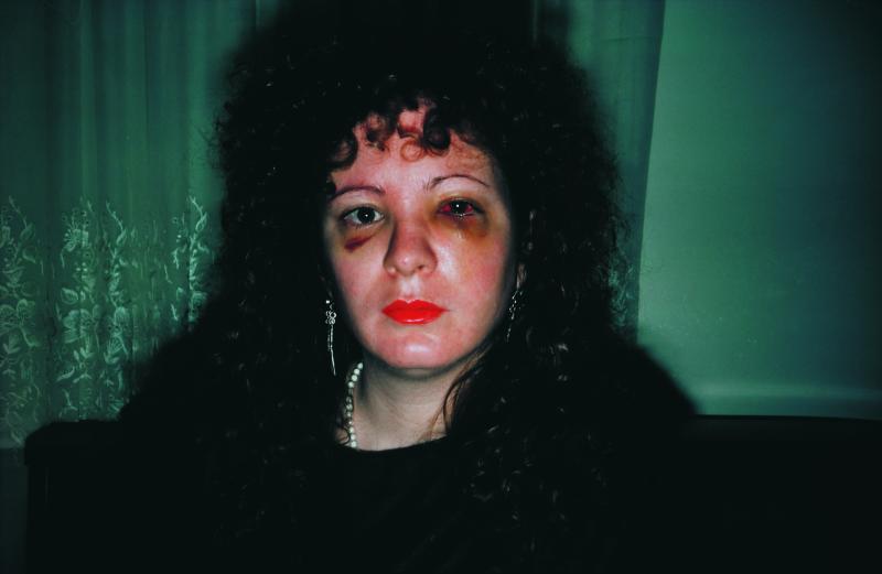 Nan Goldin Nan One Month After Being Battered, 1984 © Nan Goldin